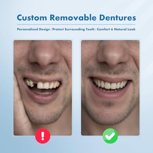 Qiivosm - Custom Removable Dentures Set for Tooth Replacement (4 Teeth)